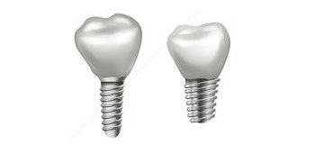 ショートインプラント